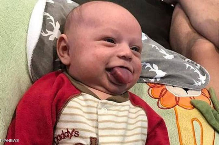 حالة طبية فريدة