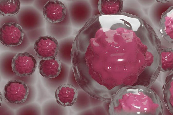 علاج ثوري.. تقنية جديدة توقف انتشار الورم