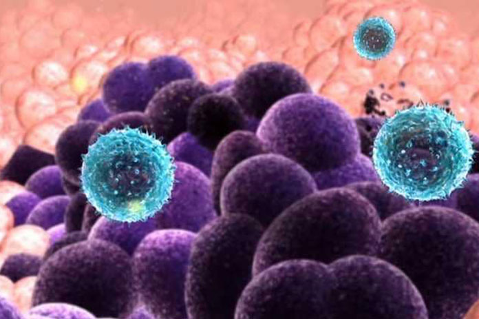 دراسة: تحسن بمعدلات مواجهة أنواع خطيرة من السرطان