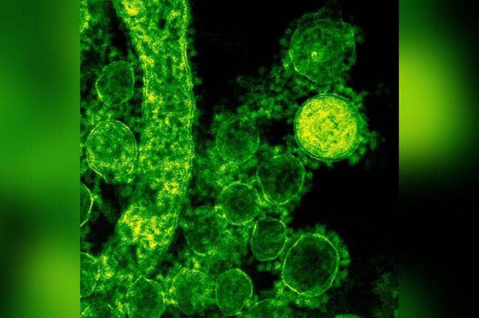 الجمرة الخبيثة العراق