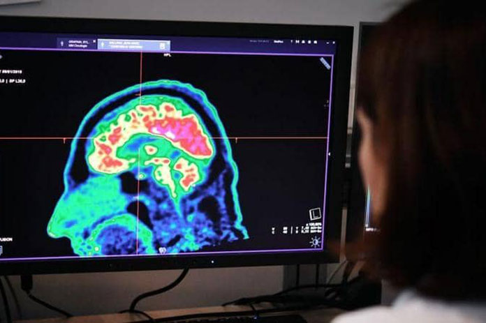 تداعيات جديدة لجائحة كورونا