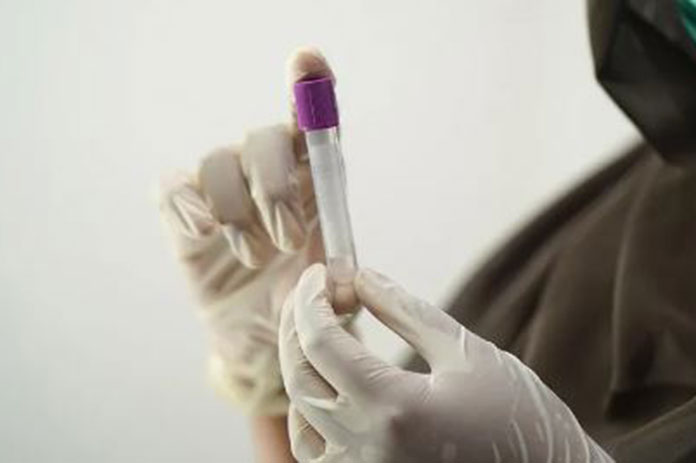 أورام الثدي