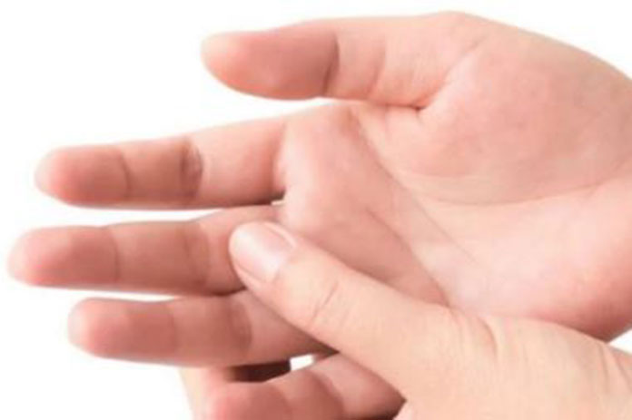 مرض الكبد الدهني