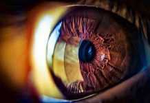 أعراض شائعة في العين قد يشير ظهورها إلى الإصابة بأمراض منقولة جنسيا