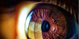 أعراض شائعة في العين قد يشير ظهورها إلى الإصابة بأمراض منقولة جنسيا